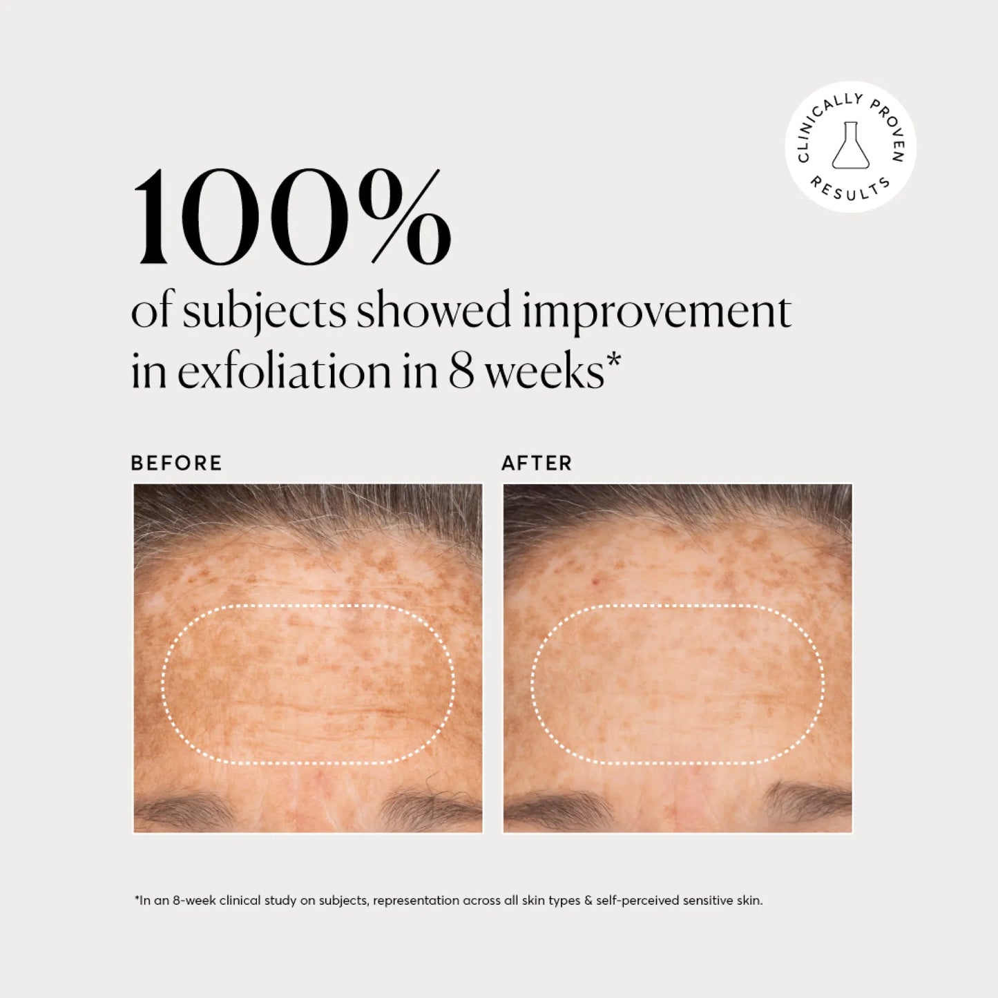 bha-liquid-exfoliant-2-n3 NATR-10027-Alt-Images-BHA-Liquid-Exfoliant-2_-03.webp